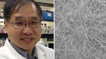 Тъканно инженерство: Копринени нишки биха могли да помогнат за регенeрацията на клетките на слюнчените жлези