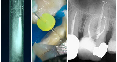 First Odne Summit marks the successful completion of the priority access programme for OdneClean