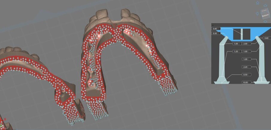 Figg. 10, 11_Esempio di distribuzione dei supporti di stampa.