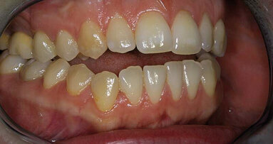 Ästhetik als „Abfallprodukt“? Die Geschichte einer schmerzhaften Odyssee.