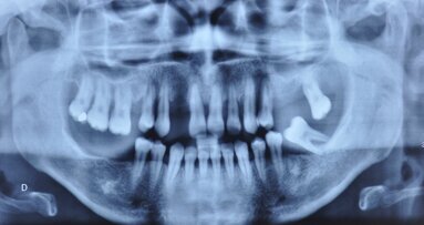 L’harmonisation du plan de traitement prothétique