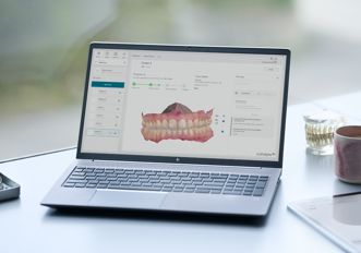 Unite 3: la nuova piattaforma di lavoro di TRIOS
