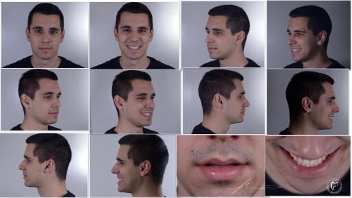 Slika 1a: Komunikacione fotografije (Zahvalnost dr Milošu Ljubičiću na fotografijama i dr Lazaru Terziću kao modelu)