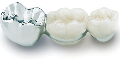 Aurident marks 35 years of making alloys