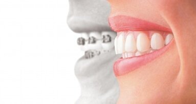 Tooth Movement: Health Science or Unhealthy Cosmetics?