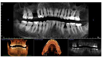 Una herramienta diagnóstica esencial