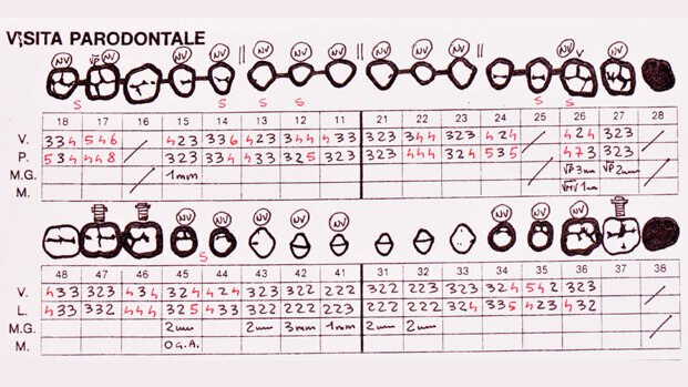 Riabilitazione complessa protesico-parodontale