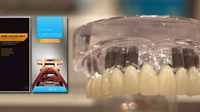 Implantologie für Experten und Einsteiger im Ruhrgebiet