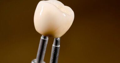 Indagine sull’usura di varie ceramiche per il restauro dei denti primari