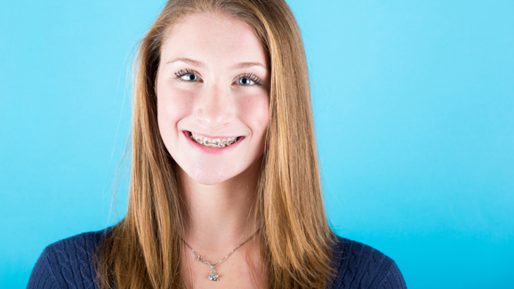 Zahnspangenträger glücklich mit Ergebnis