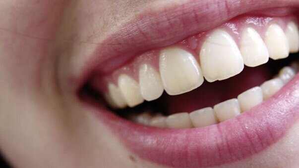 Coenzyme Q10 : une molécule naturelle améliore l’état gingival