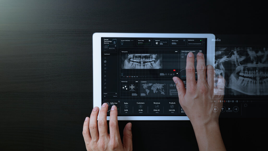 人工智能基于的工具在上颌尖牙的筛选中表现出准确性