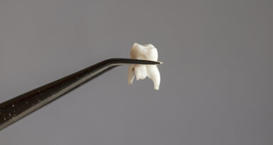 Machine-learning algorithms may help in predicting tooth loss