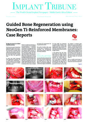 Implant Tribune Middle East & Africa No. 3, 2017