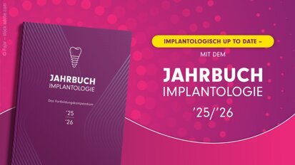 Rundum implantologisch informiert mit dem neuen Jahrbuch Implantologie 25/26 Rundum implantologisch informiert mit dem neuen Jahrbuch Implantologie 25/26