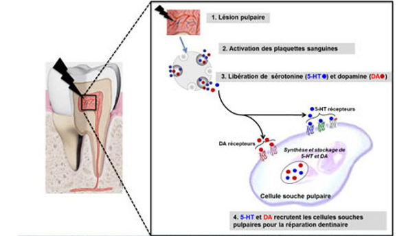 Découverte fondamentale sur le pouvoir naturel de réparation des dents