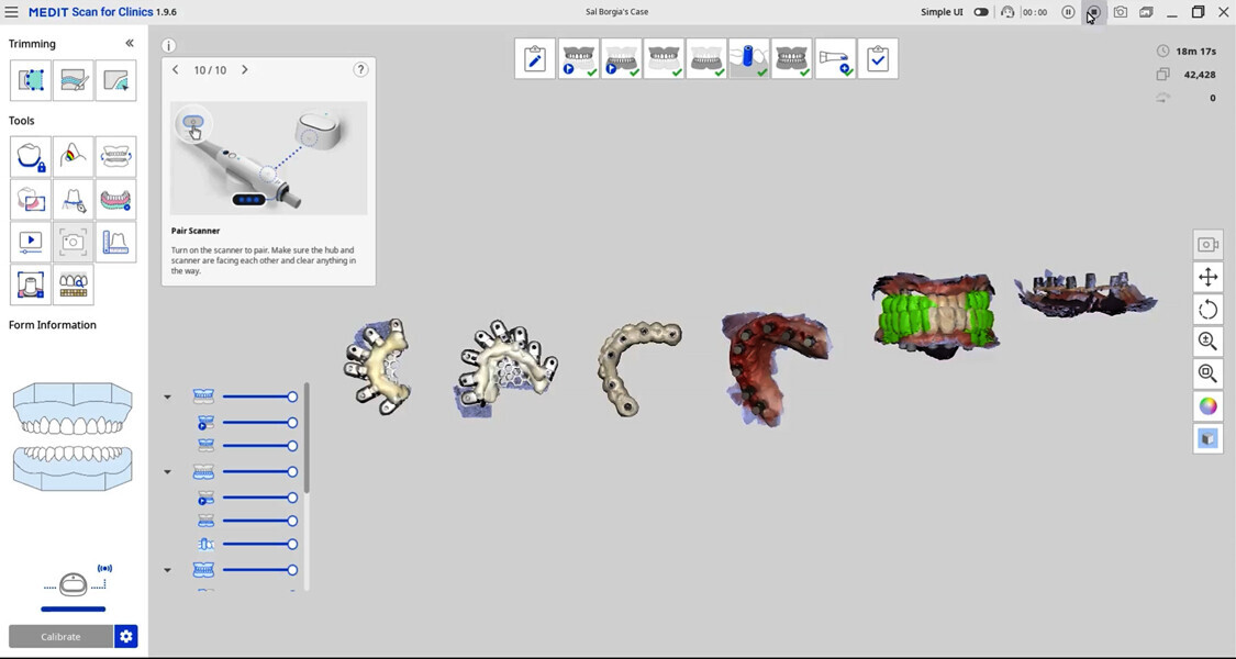 Fig. 15b: Intra-oral scanning Grammetry workflow for transfer to the dental laboratory.
