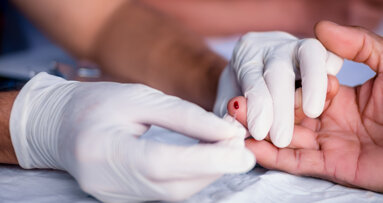 Study investigates chairside HIV testing in London dental clinics
