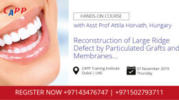 Reconstruction of Large Ridge Defect by Particulated Grafts and Membranes...