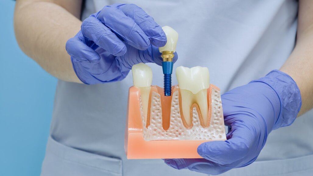 Global Osseointegration Day webinar: Advances in bionic limb reconstruction