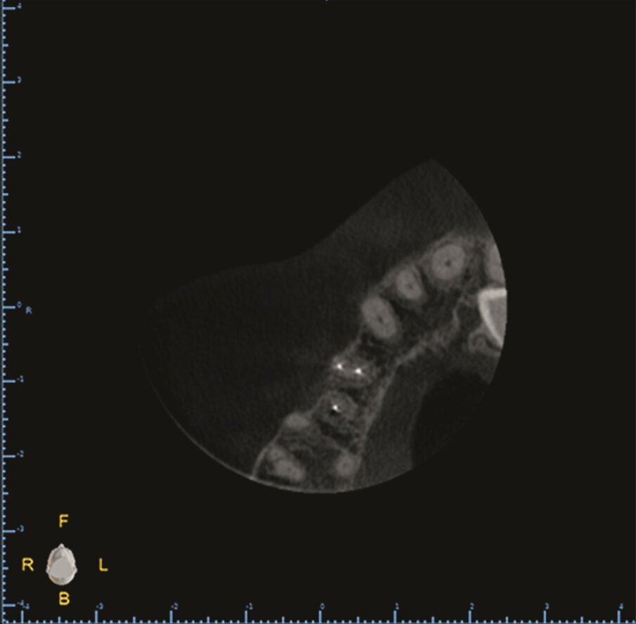 … and axial views (c).