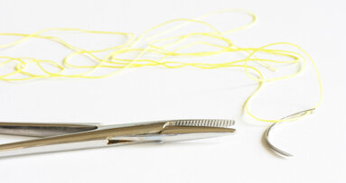 Neue Methode zum Wundverschluss