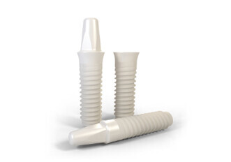 Straumann PURE Ceramic Implant System