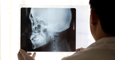 Bei Rheuma immer auch zum MKG-Chirurgen