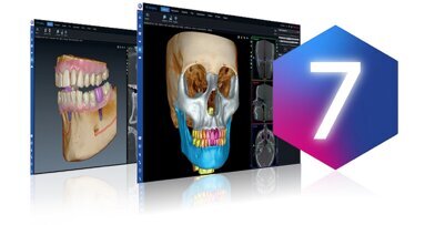 Planmeca launches Romexis 7 with advanced AI tools