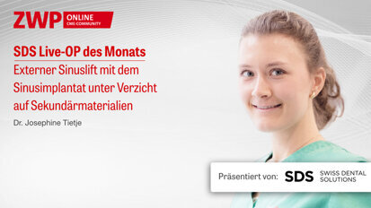 1 CME-Punkt: SDS Live-OP mit Dr. Josephine Tietje im Archiv abrufbar 1 CME-Punkt: SDS Live-OP mit Dr. Josephine Tietje im Archiv abrufbar