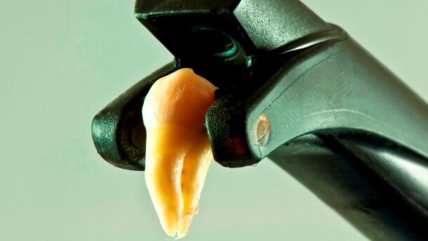 Laserowe obrazowanie i diagnostyka próchnicy w technologii NIDIFOTI