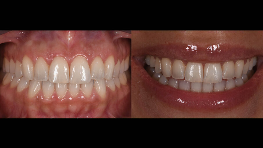 Fig. 16_Follow up a 90 giorni.