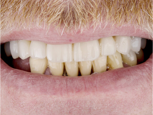 Konečná situace po 3 letech