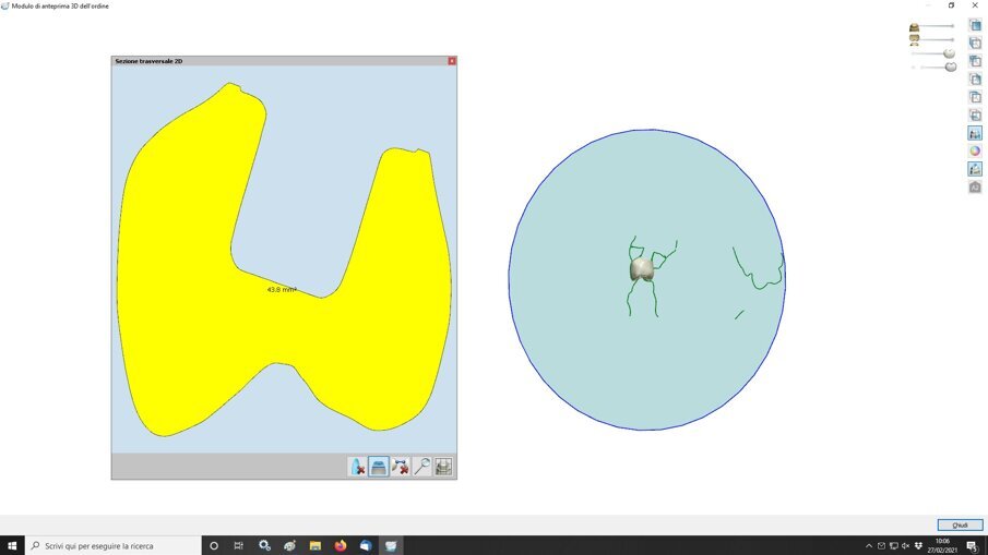 Fig. 12_È possibile estrapolare una serie di dati tecnici molto interessanti che contemplano la superficie di contatto, al fine di valutare la stabilità del manufatto e l’interazione gnatologica funzionale.