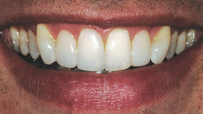 A banker’s bond: When less is more A banker’s bond: When less is more