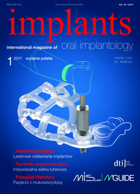 implants Poland No. 1, 2017 implants Poland No. 1, 2017