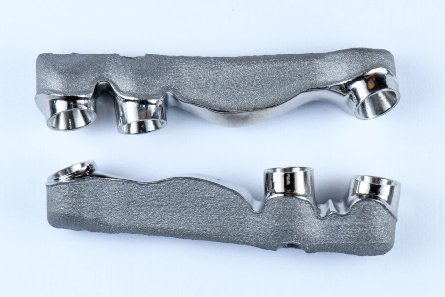 Obr. 13–18: Konstrukce Atlantis BridgeBase, zirkonové můstky a finální náhrady.