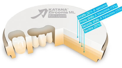 KATANA Zirconia ML (Multi-Layered) Disc, la prima zirconia policromatica al mondo