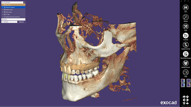 Exocad’s first international congress hailed a success