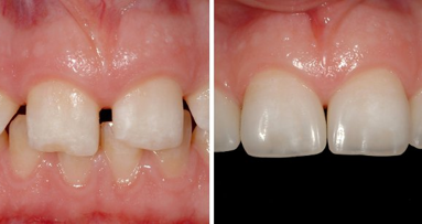 Регистрирайте се за безплатен уебинар с д-р Дидие Диечи