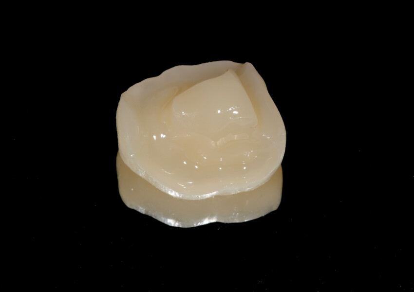Fig. 21b: Milled resin composite endocrown after characterisation and polishing intaglio surfaces.