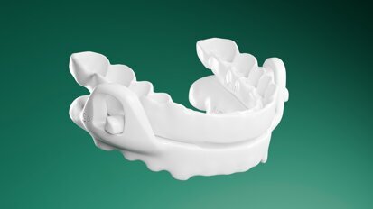 Un estudio confirma la eficacia de los DAM en la apnea obstructiva del sueño