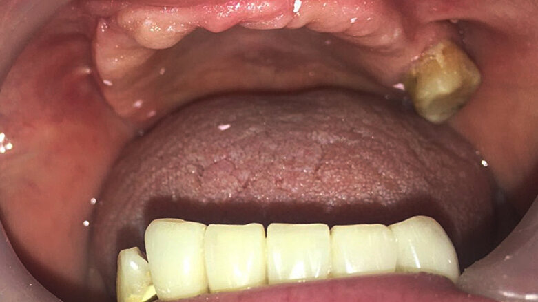 El Presidente de Brasil veta el Proyecto de Odontología Hospitalaria