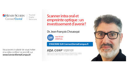 Webinaire : Scanner intra oral et empreinte optique : un investissement d’avenir ?