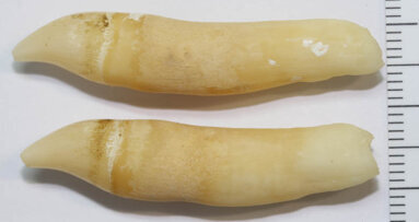 Research on dolphin teeth may hold vital information on ocean pollution