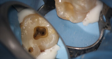 Principle-driven endodontics: Proven case results
