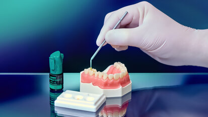 Bonding agent receives DENTAL ADVISOR awards