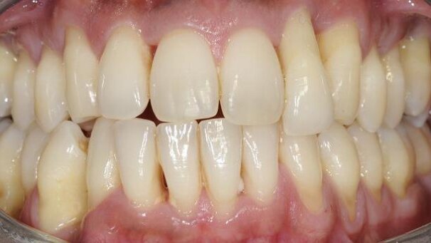 Practical periodontics in daily practice