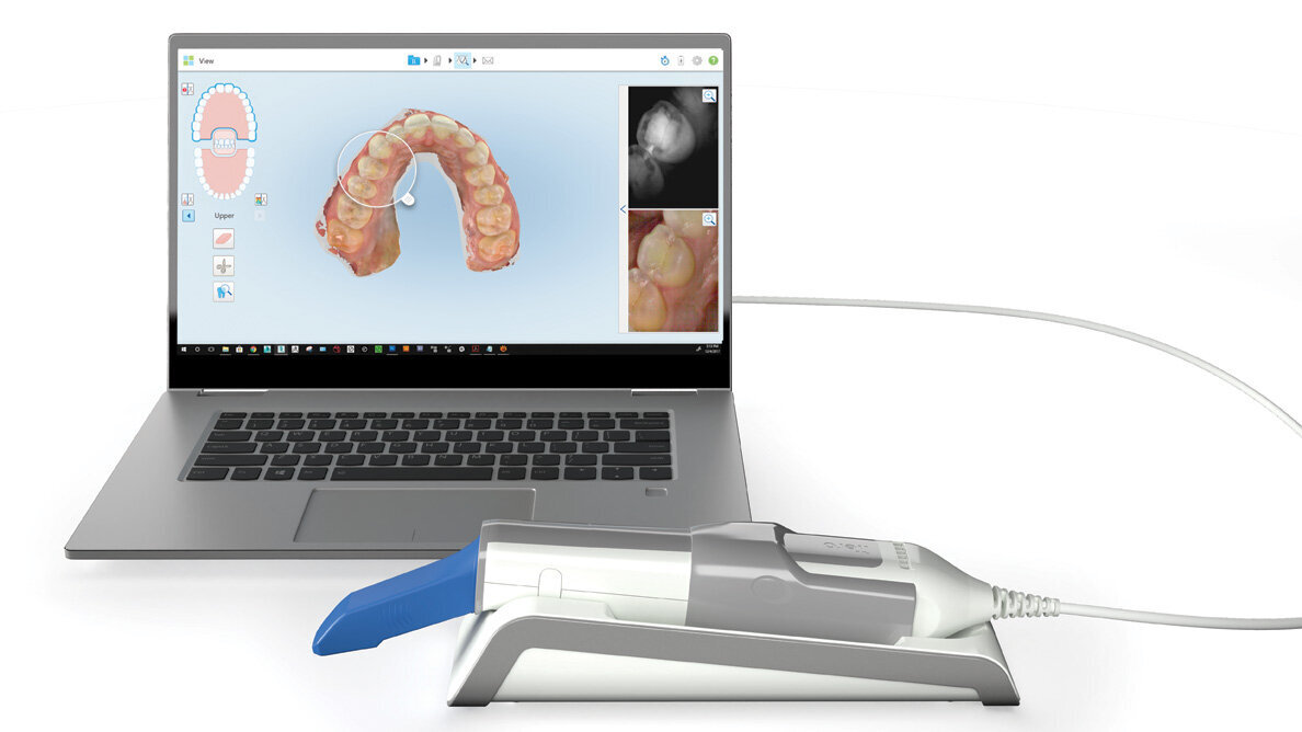 Seeing is believing: iTero Element 5D Imaging System