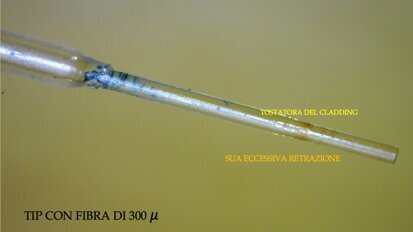 Attivazione della fibra del Laser a Diodo